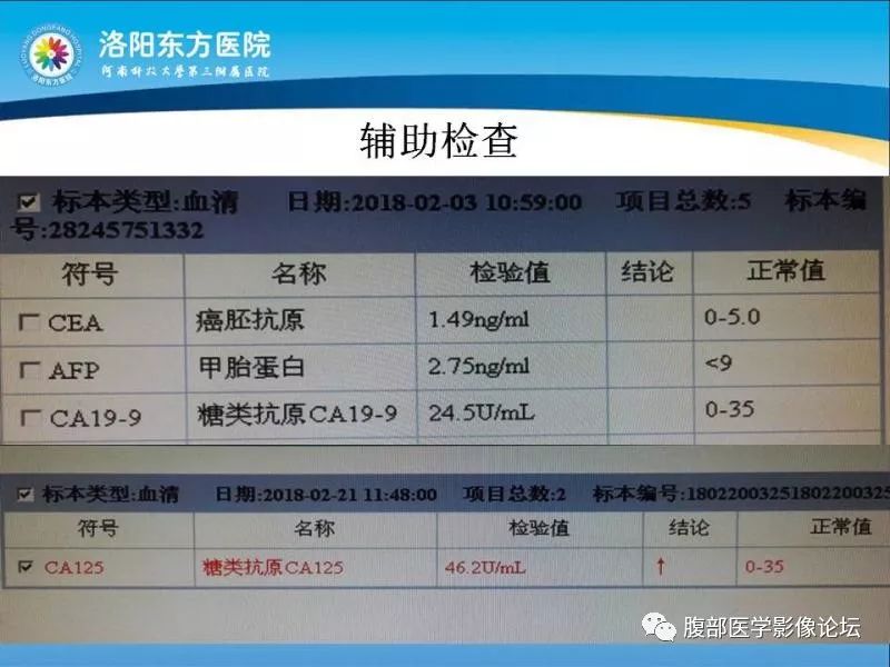 【病例】子宫内膜间质肉瘤1例MR