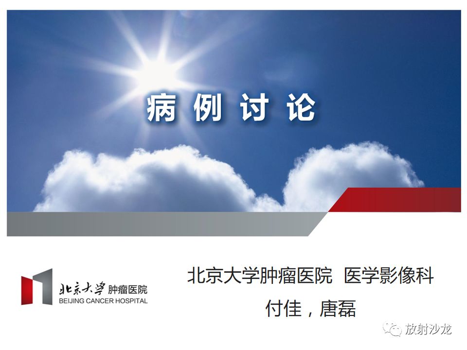 【病例】胃神经鞘瘤1例CT影像表现