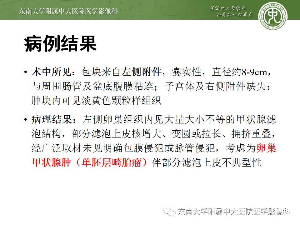 【病例】卵巢甲状腺肿1例CT影像表现