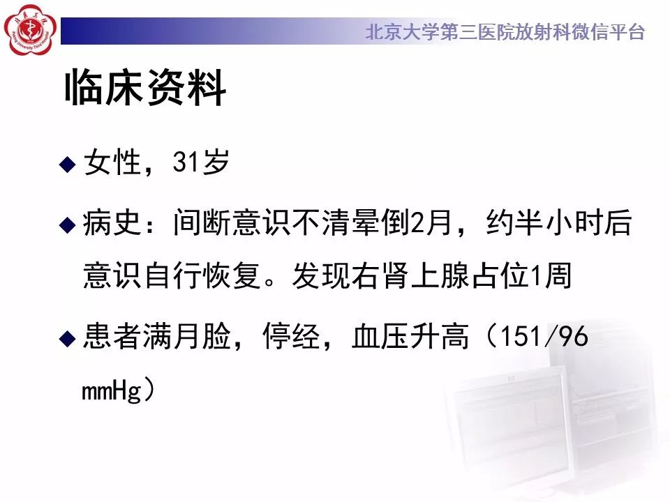 【病例】肾上腺皮质腺癌1例CT及MR影像表现