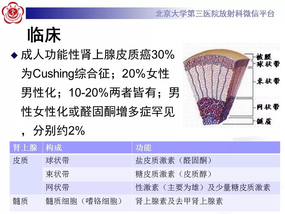 【病例】肾上腺皮质腺癌1例CT及MR影像表现