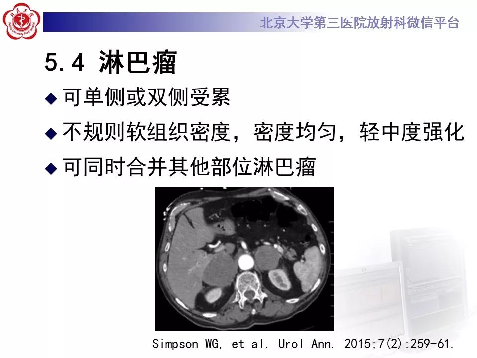 【病例】肾上腺皮质腺癌1例CT及MR影像表现
