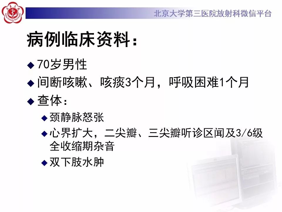 【病例】心肌淀粉样变性1例MR影像表现