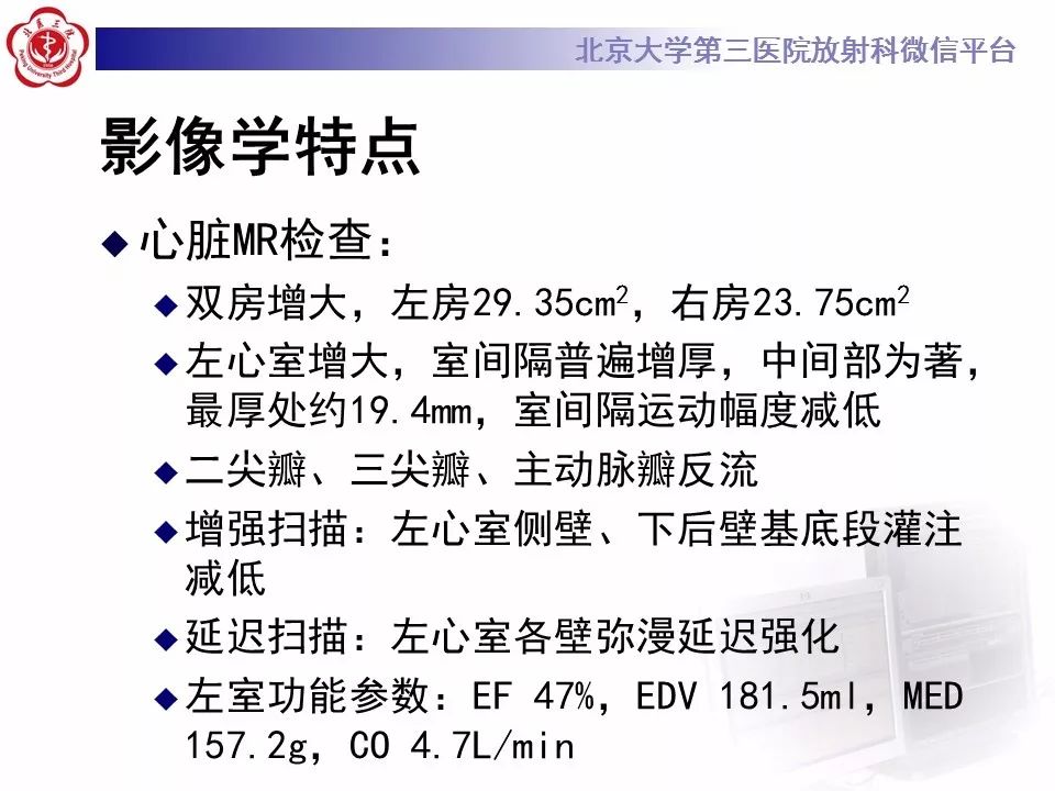【病例】心肌淀粉样变性1例MR影像表现
