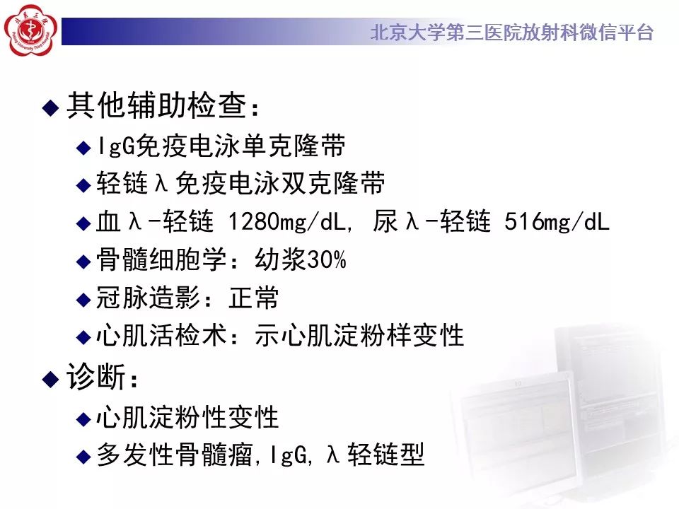 【病例】心肌淀粉样变性1例MR影像表现