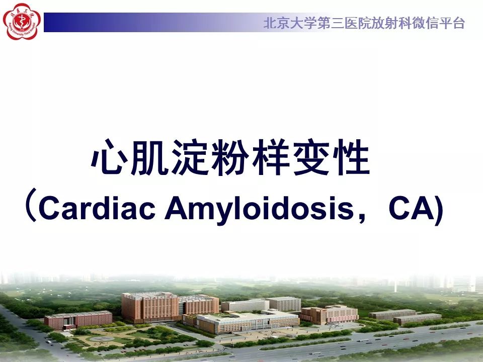 【病例】心肌淀粉样变性1例MR影像表现