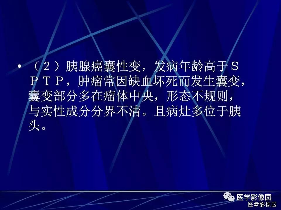 【病例】胰腺实性假乳头状瘤1例CT影像表现