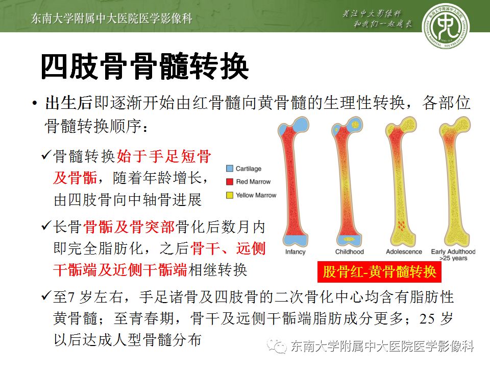 【病例】白血病骨髓浸润1例MR影像表现 【病例】白血病骨髓浸润1例MR影像表现