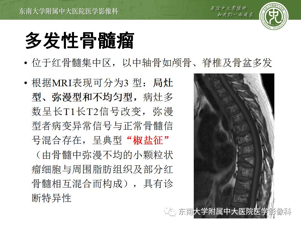 【病例】白血病骨髓浸润1例MR影像表现 【病例】白血病骨髓浸润1例MR影像表现