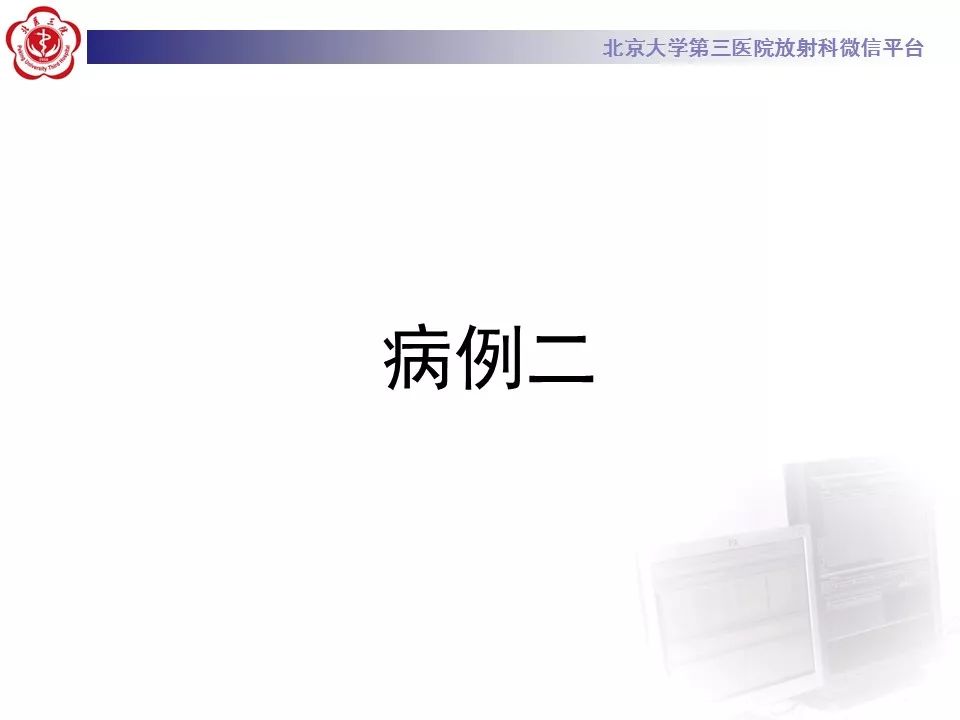 【病例】基底动脉尖综合征2例影像诊断