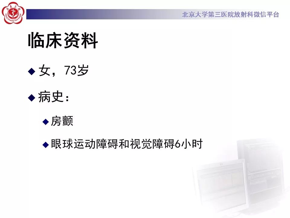【病例】基底动脉尖综合征2例影像诊断