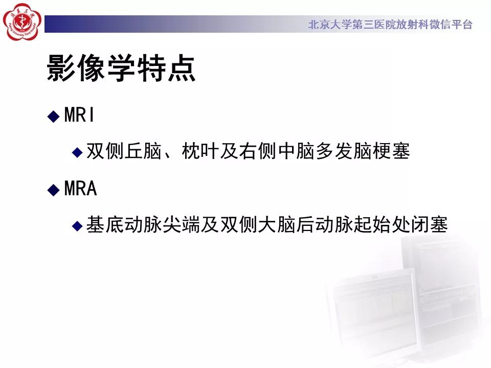 【病例】基底动脉尖综合征2例影像诊断