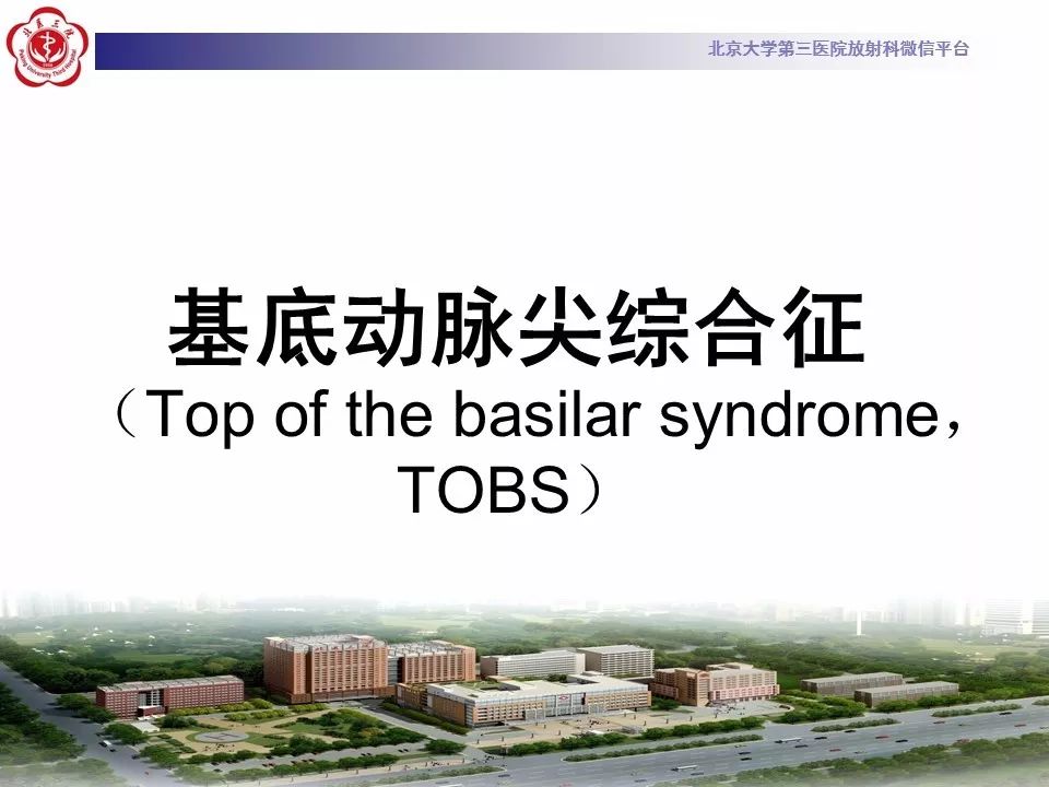 【病例】基底动脉尖综合征2例影像诊断