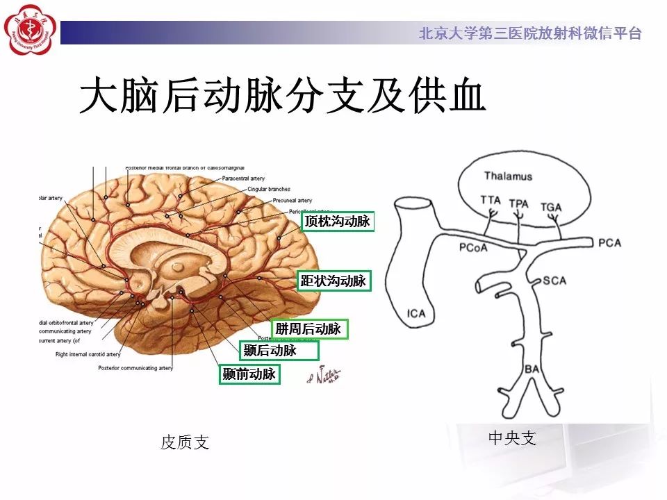 【病例】基底动脉尖综合征2例影像诊断