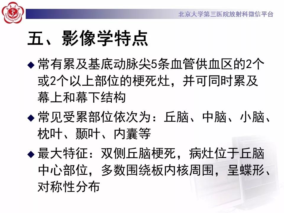 【病例】基底动脉尖综合征2例影像诊断