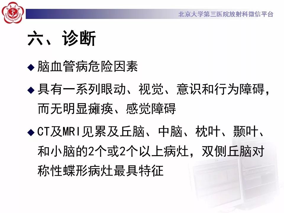【病例】基底动脉尖综合征2例影像诊断