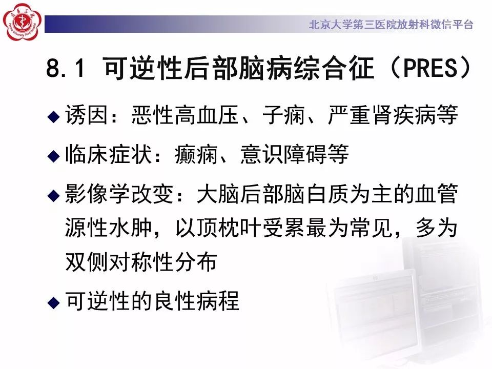【病例】基底动脉尖综合征2例影像诊断