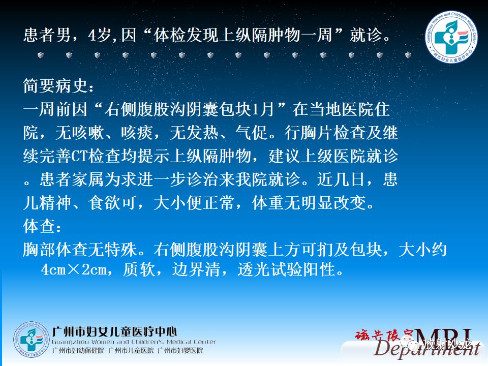 【病例】小儿真性胸腺增生1例CT影像表现