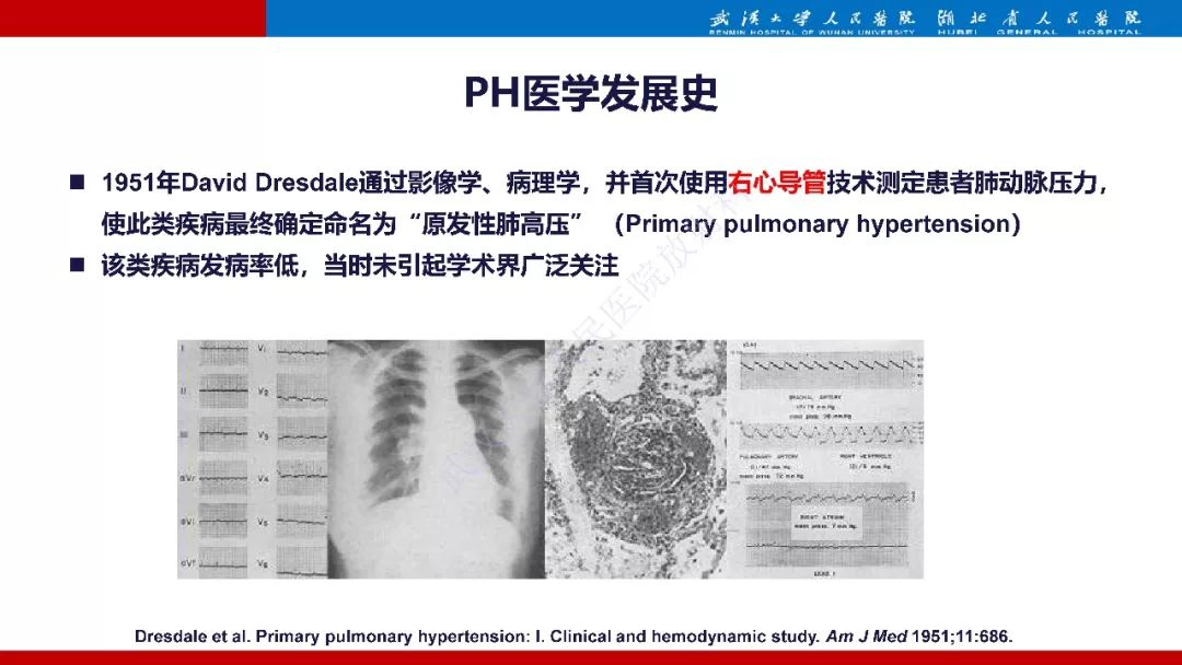 【PPT】肺动脉高压临床分类及CT表现