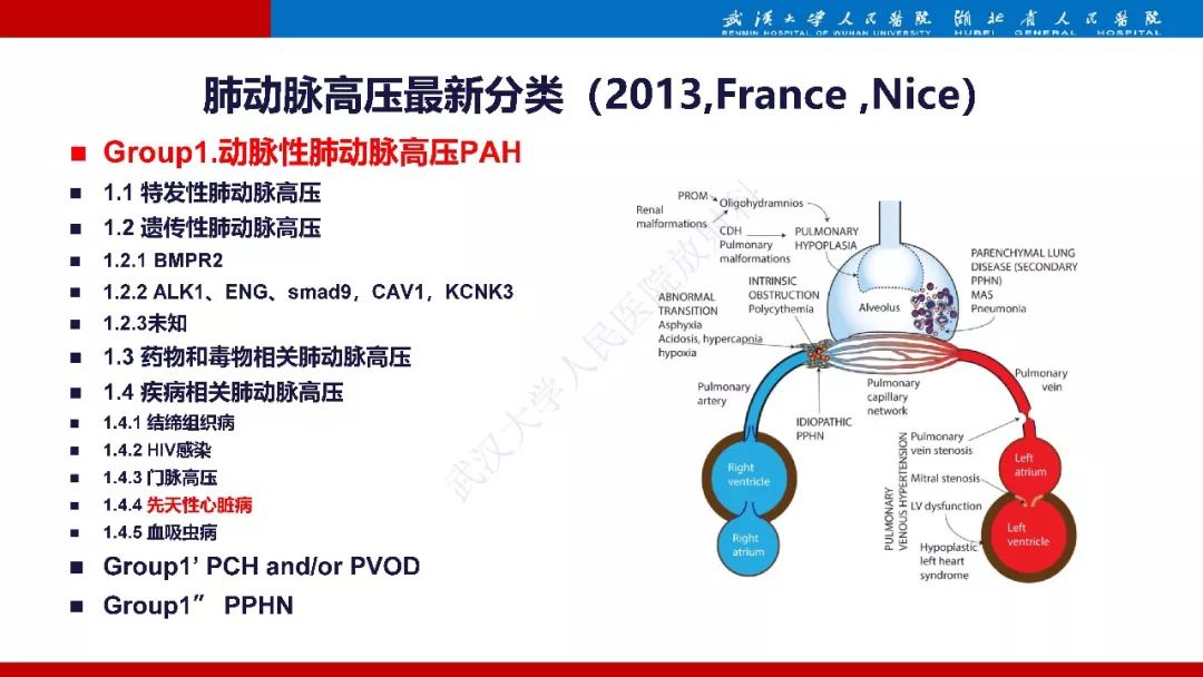 【PPT】肺动脉高压临床分类及CT表现