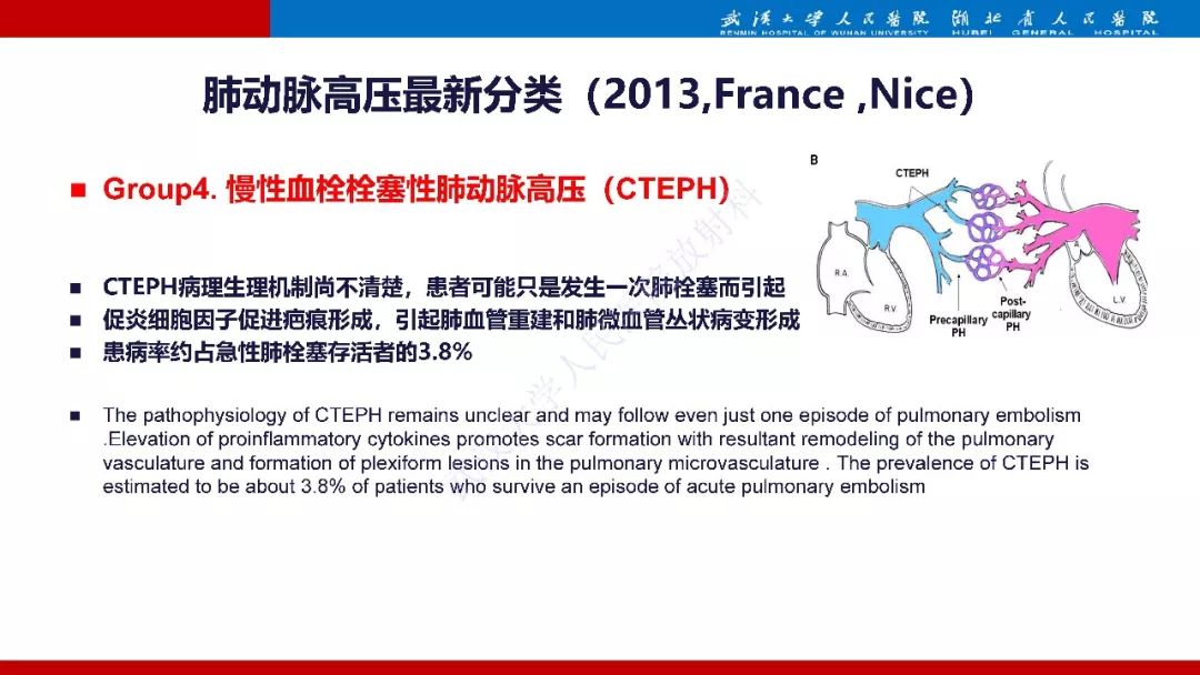【PPT】肺动脉高压临床分类及CT表现