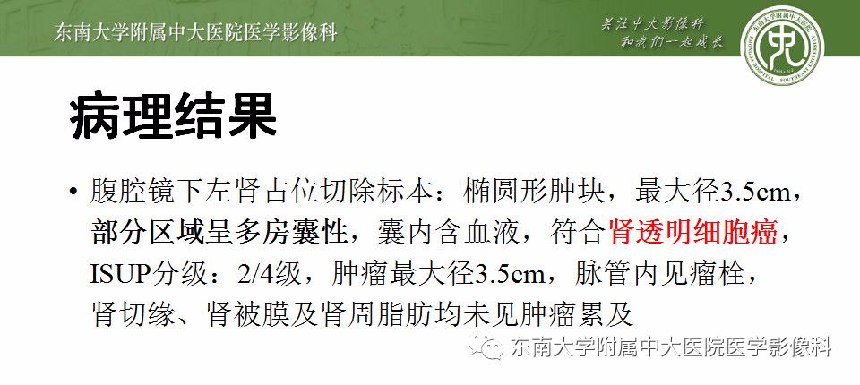 【病例】囊性肾癌(左肾透明细胞癌)1例CT影像表现