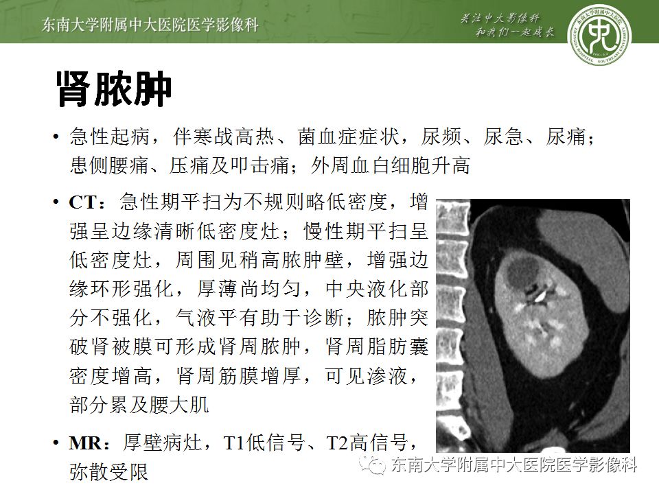 【病例】囊性肾癌(左肾透明细胞癌)1例CT影像表现