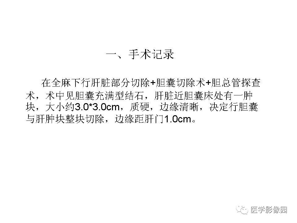 【病例】低分化肝癌1例MR影像表现