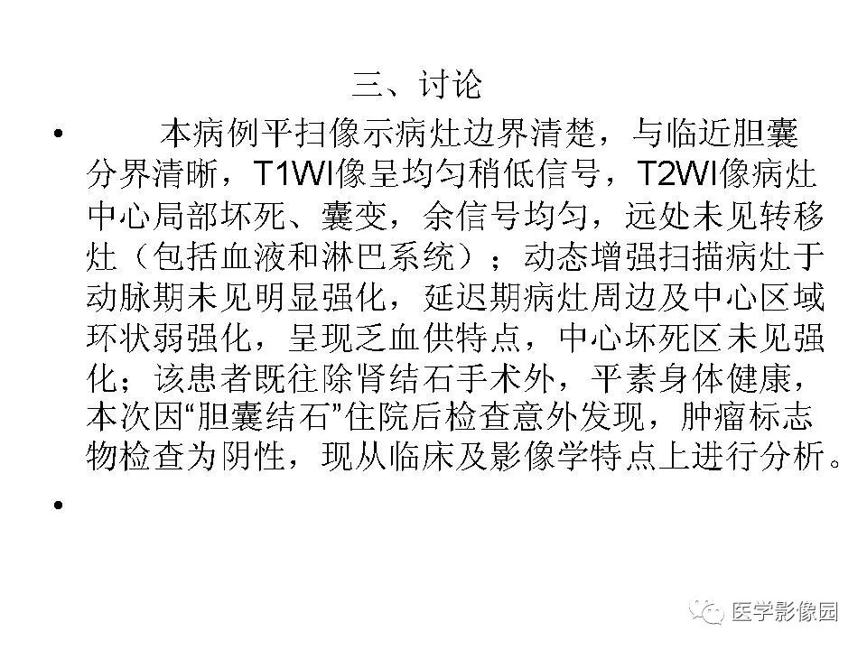 【病例】低分化肝癌1例MR影像表现