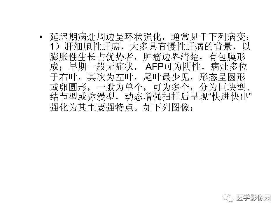 【病例】低分化肝癌1例MR影像表现