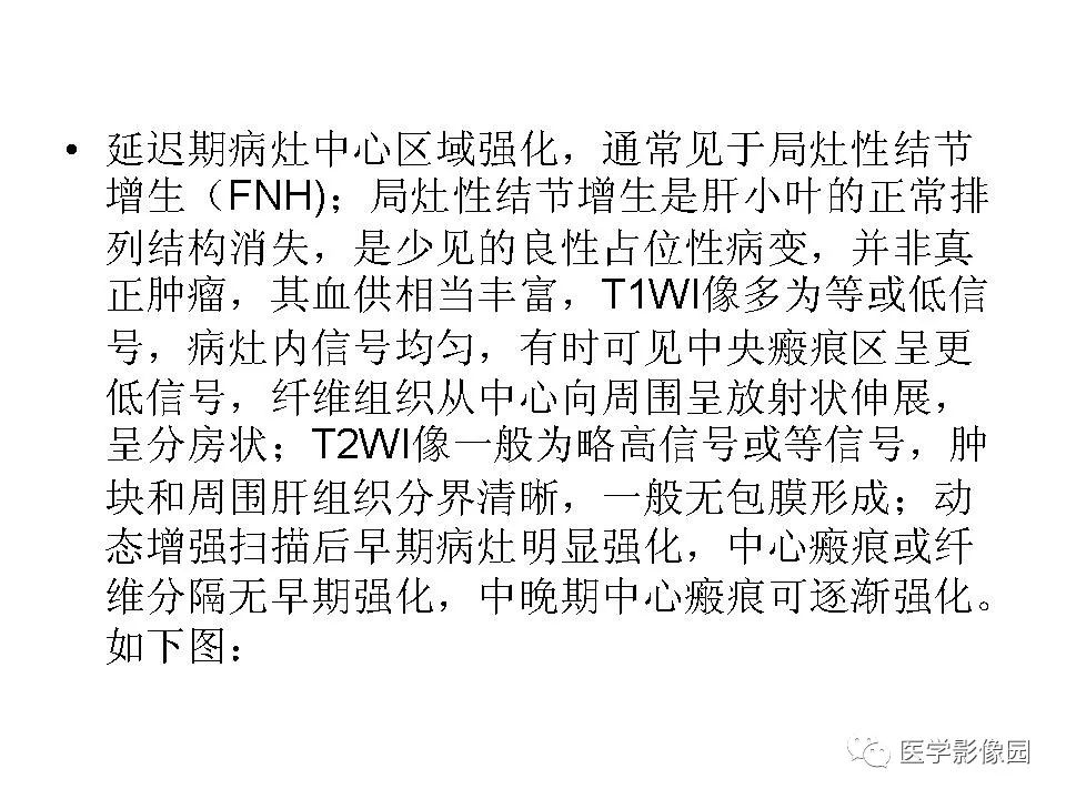 【病例】低分化肝癌1例MR影像表现