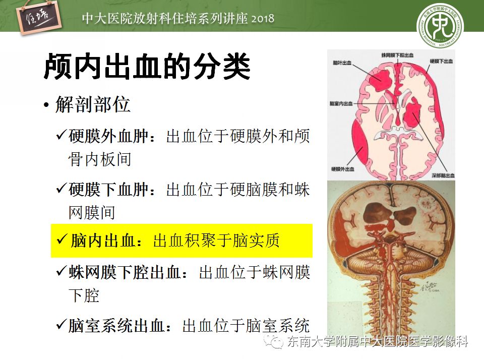 【PPT】脑内出血转归影像学表现