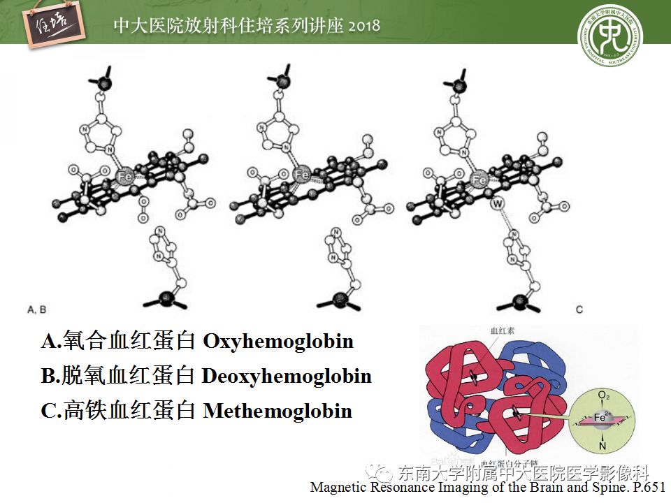 【PPT】脑内出血转归影像学表现