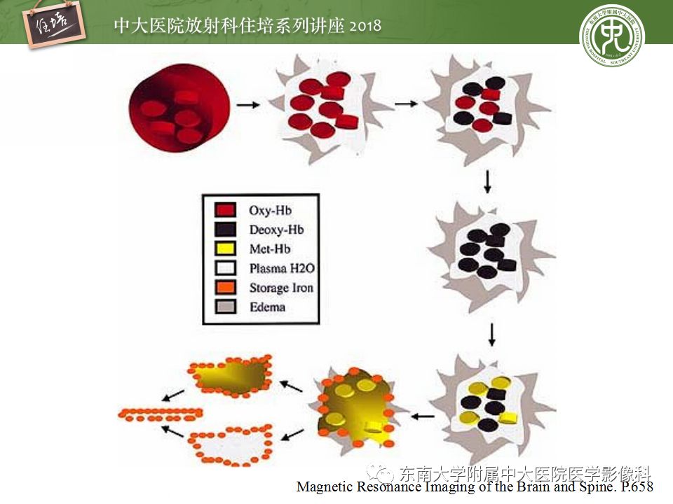 【PPT】脑内出血转归影像学表现