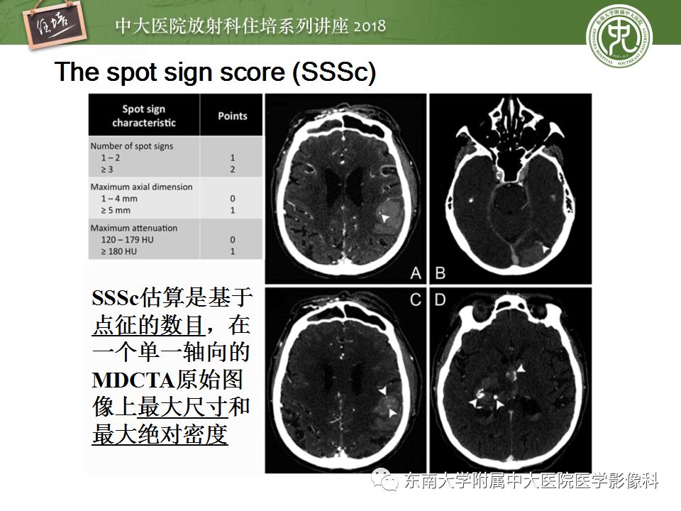 【PPT】脑内出血转归影像学表现