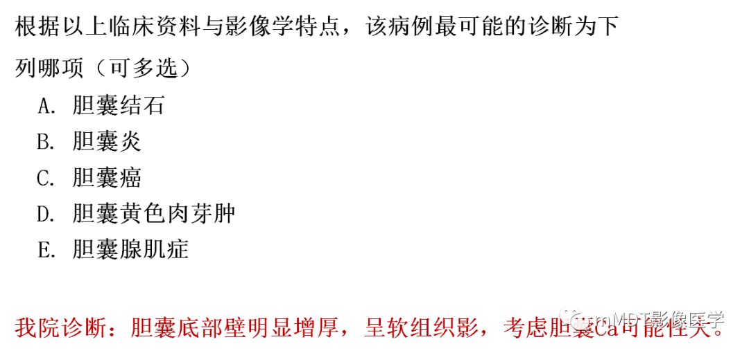 【PPT】黄色肉芽肿性胆囊炎