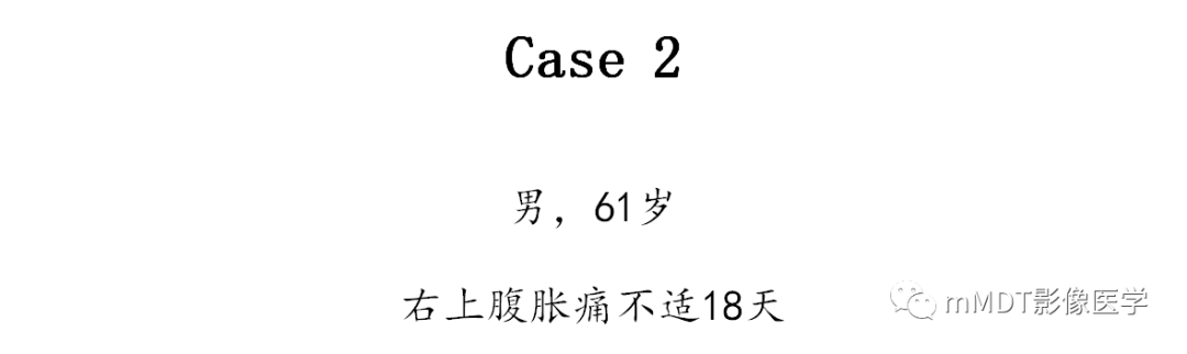 【PPT】黄色肉芽肿性胆囊炎