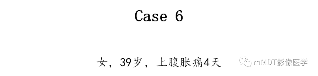 【PPT】黄色肉芽肿性胆囊炎