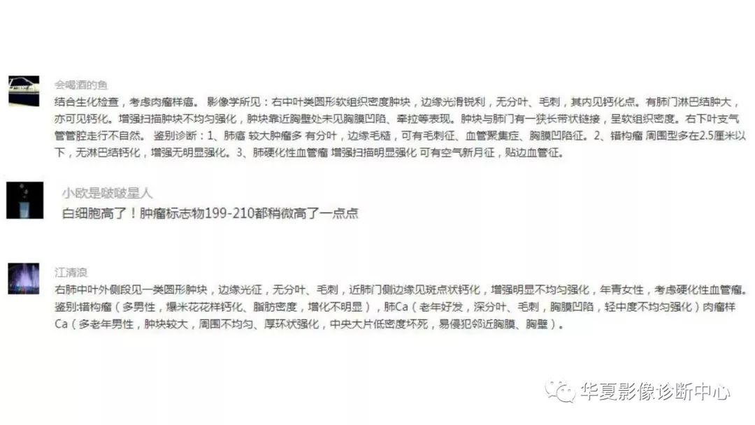 【病例】肺肉瘤样癌1例CT影像表现