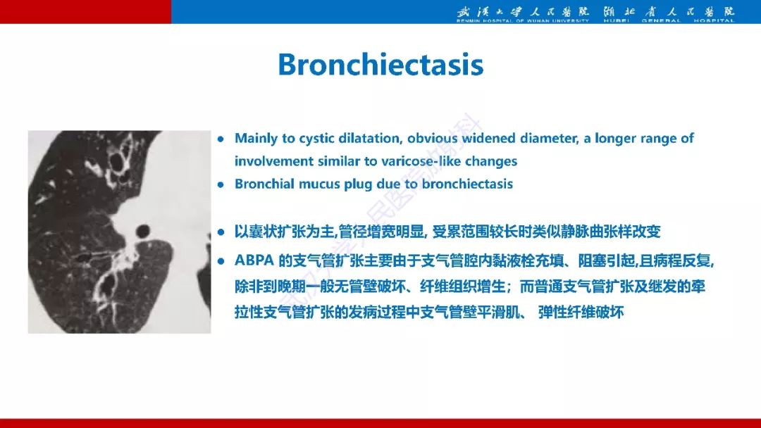【PPT】变应性支气管肺曲霉病影像诊断