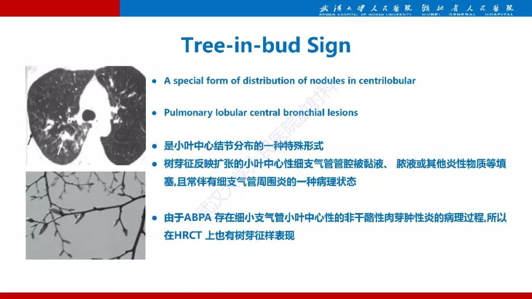 【PPT】变应性支气管肺曲霉病影像诊断