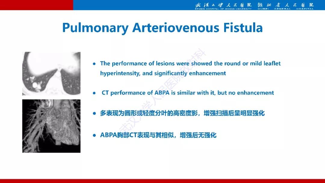 【PPT】变应性支气管肺曲霉病影像诊断