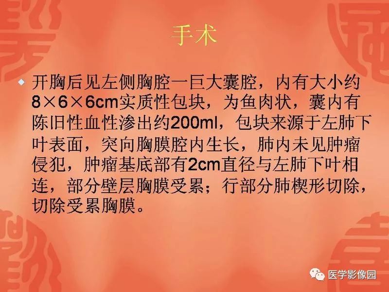 【病例】儿童肺母细胞瘤1例CT影像表现
