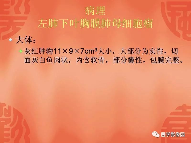 【病例】儿童肺母细胞瘤1例CT影像表现