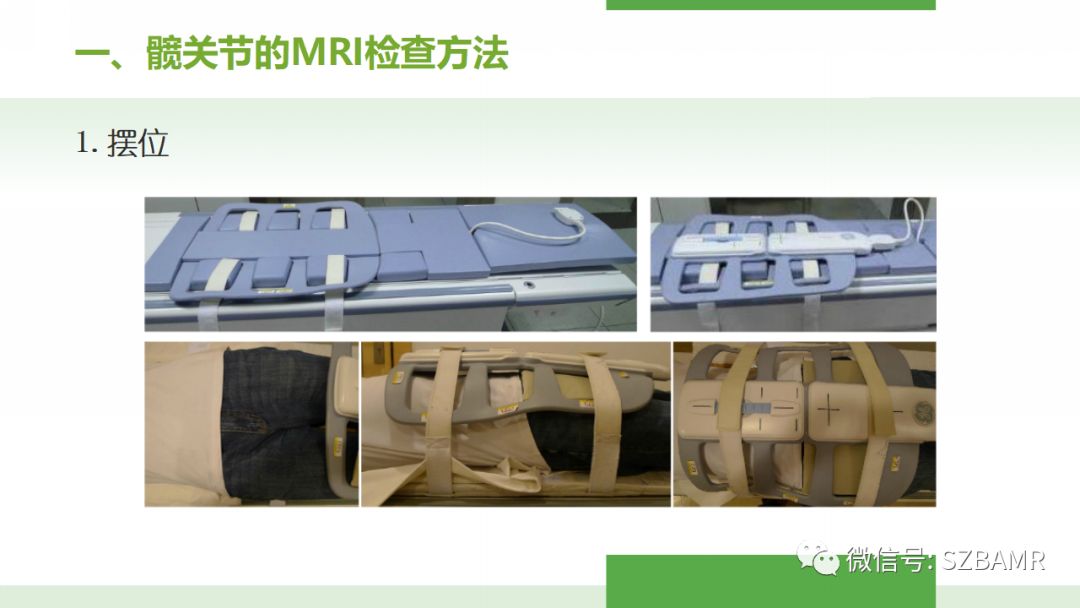 【PPT】股骨头缺血性坏死及类似髋关节疾病的影像诊断与鉴别