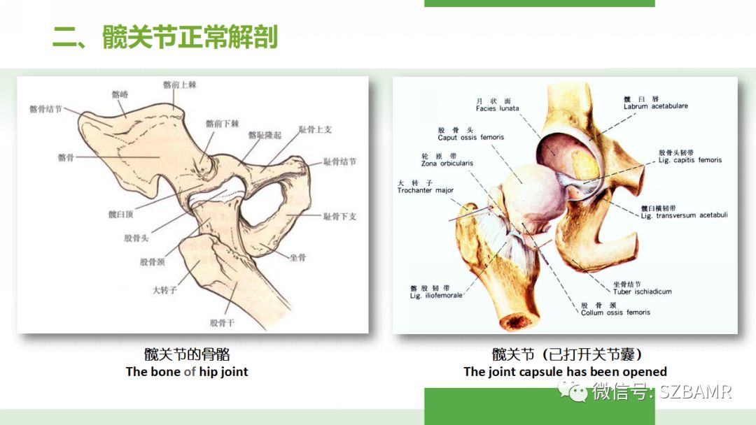 【PPT】股骨头缺血性坏死及类似髋关节疾病的影像诊断与鉴别