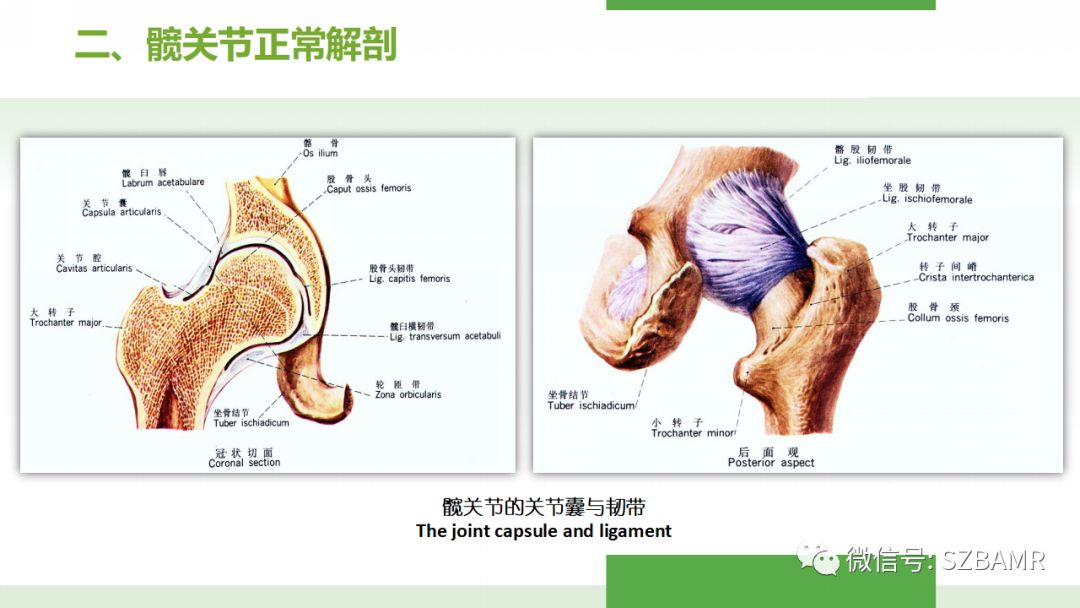 【PPT】股骨头缺血性坏死及类似髋关节疾病的影像诊断与鉴别