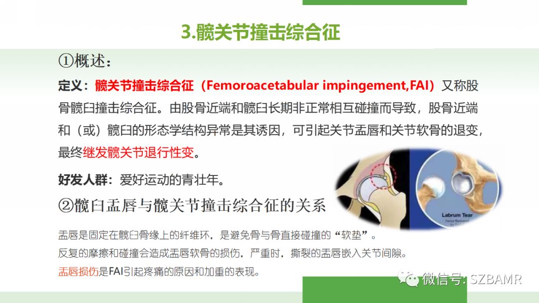 【PPT】股骨头缺血性坏死及类似髋关节疾病的影像诊断与鉴别