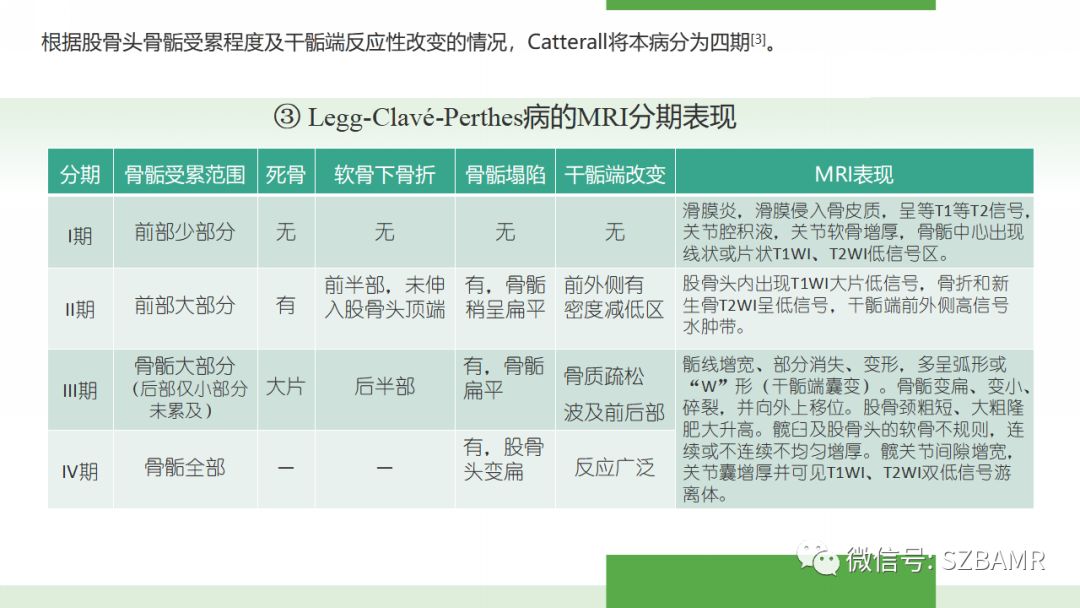 【PPT】股骨头缺血性坏死及类似髋关节疾病的影像诊断与鉴别