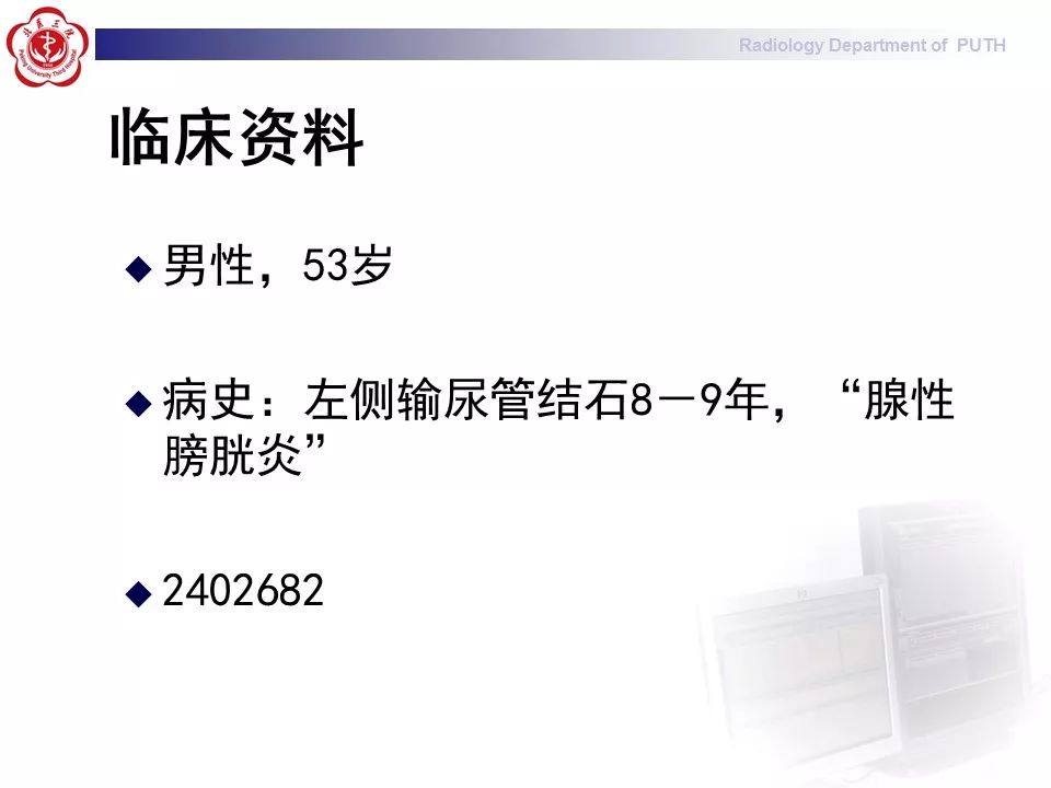 【病例】盆腔脂肪增多症1例CT影像表现